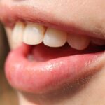 「口に関するアンケート」　背筋